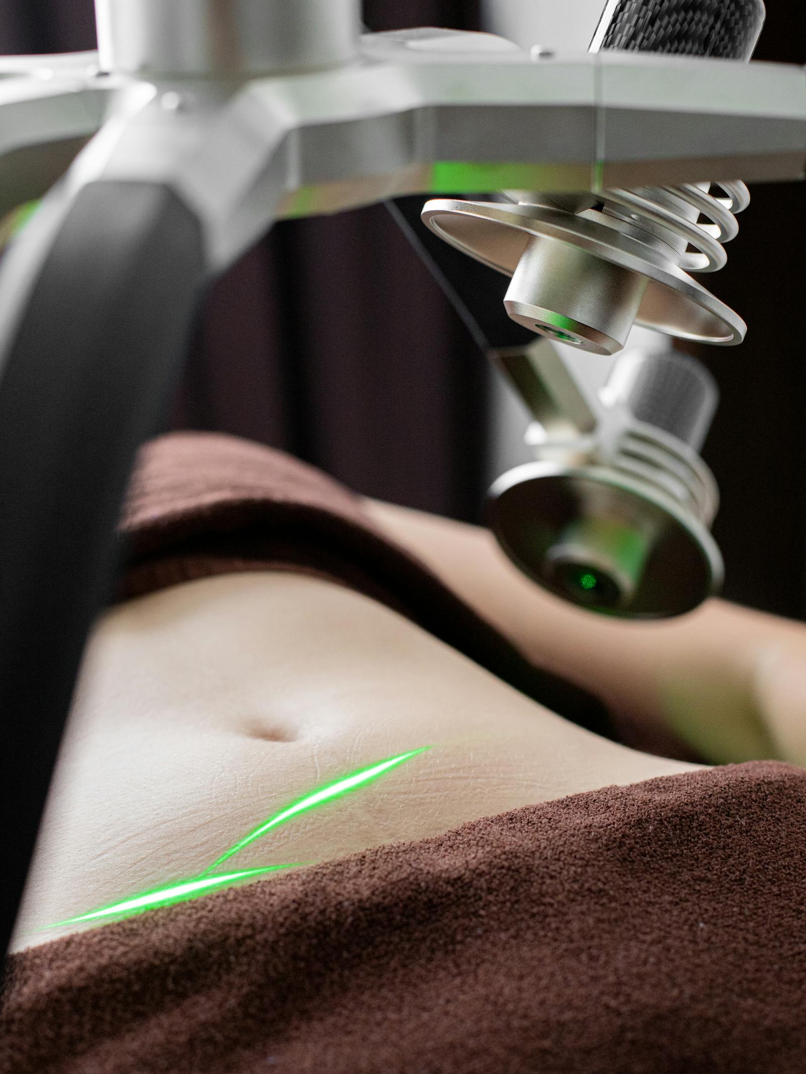 Tratamiento antiage con radiofrecuencia